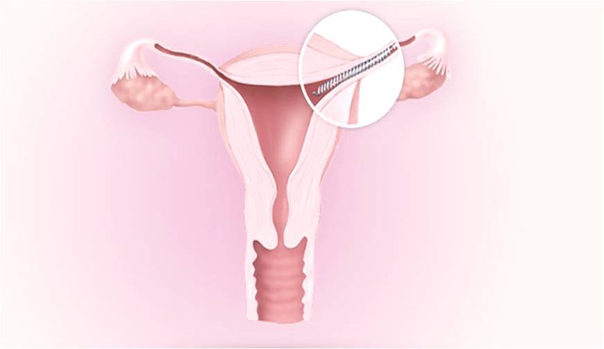 Autoría desconocida